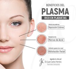 plasma rico en plaquetas, el mejor regalo para la piel de tu rostro!