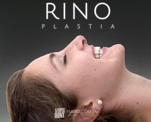 Rinoplastia - Dr Fulvio Alexander Correa