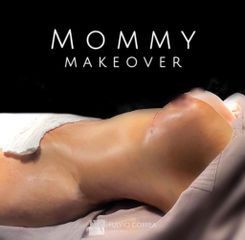 Mommy mskeover - Dr Fulvio Alexander Correa