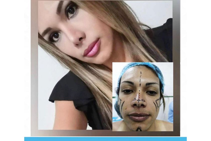 Cirugía maxilofacial antes y después - 649516