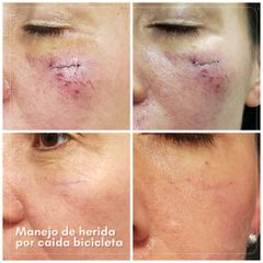 Cicatriz - Dra. Natalia Reyes