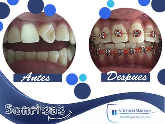 Ortodoncia - 593018