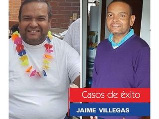 Tratamientos para adelgazar