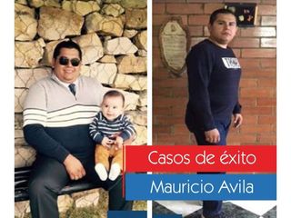 Tratamientos para adelgazar