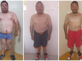 Manga Gástrica antes y después - 848393