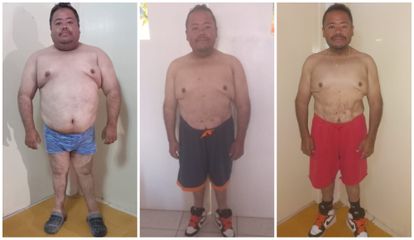 Manga gástrica - Dr. Andrés Felipe Salazar