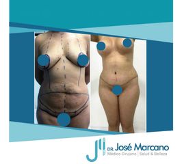 Dr. Jose Alejandro Marcano Delgado 