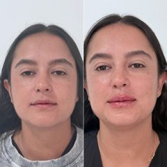 Dra. Olga Gomez Montoya