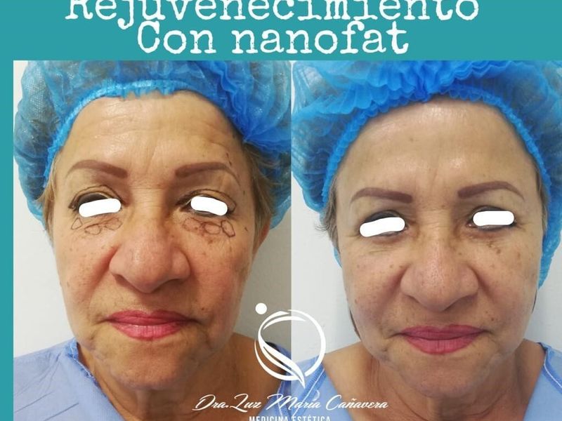 Dra. Luz María Cañavera