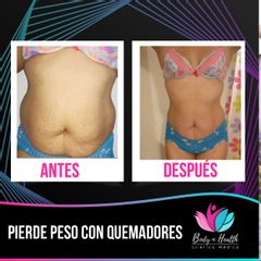Body N´Health - Quemadores