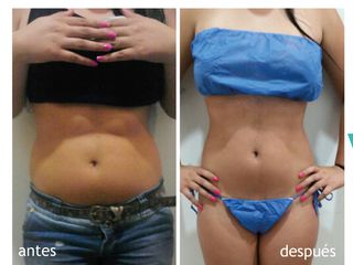 ANTES DESPUES-MED BIOLOGICA