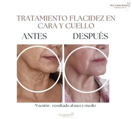 Hilos tensores - Dra. Fanny Rosero Narváez