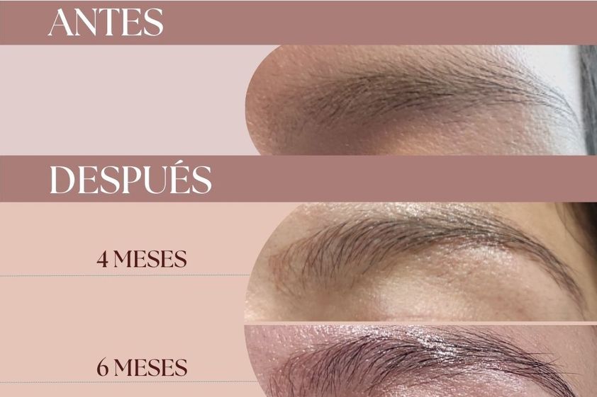 Microblading antes y después - 845589