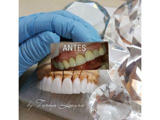  Sonrisa Perfecta Dental - Dra. Tarsys Loayza Roys 