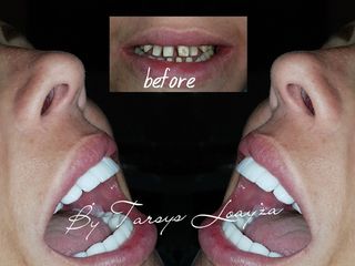  Sonrisa Perfecta Dental - Dra. Tarsys Loayza Roys 