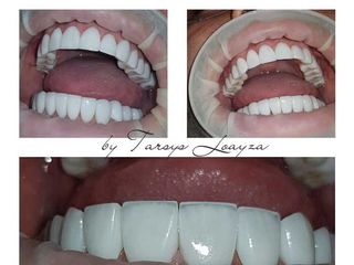  Sonrisa Perfecta Dental - Dra. Tarsys Loayza Roys 