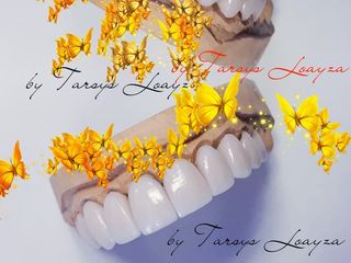 Sonrisa Perfecta Dental - Dra. Tarsys Loayza Roys 