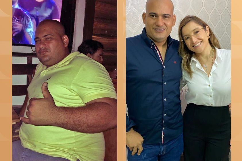 Balón Gástrico antes y después - 812295
