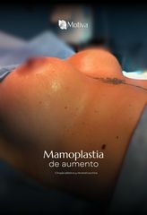 MAMOPLASTIA DE AUMENTO -IDÉALISTE