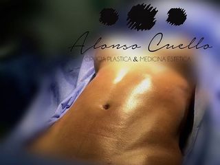 MARCACIÓN ANATOMICA , TECNICA SOFT, DR A / C