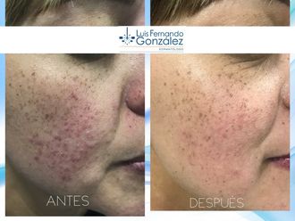 Manchas en la piel - 628156