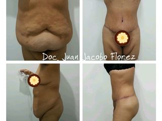 Dr. Juan Jacobo Florez