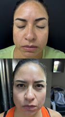 Cosmelan - Dr. Antiedad