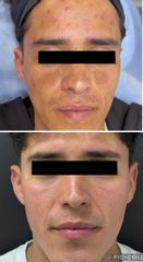 Cosmelan - Dr. Antiedad