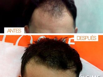 Tratamientos para el cabello - 632067