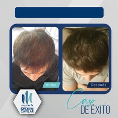 Tratamientos para el cabello - Mediarte