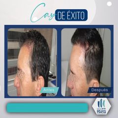 Tratamientos para el cabello - Mediarte