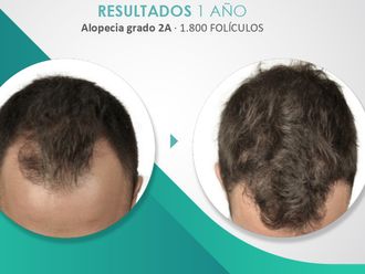 Tratamientos para el cabello - 790060