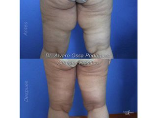 Dr. Álvaro Ossa