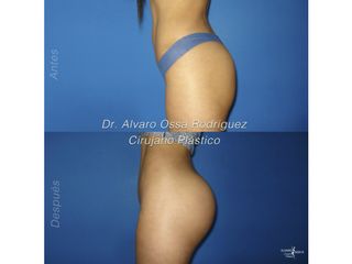 Dr. Álvaro Ossa