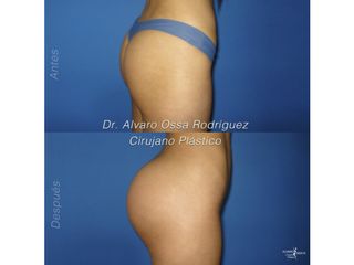 Dr. Álvaro Ossa
