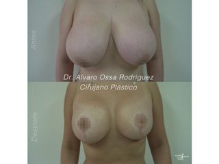 Dr. Álvaro Ossa