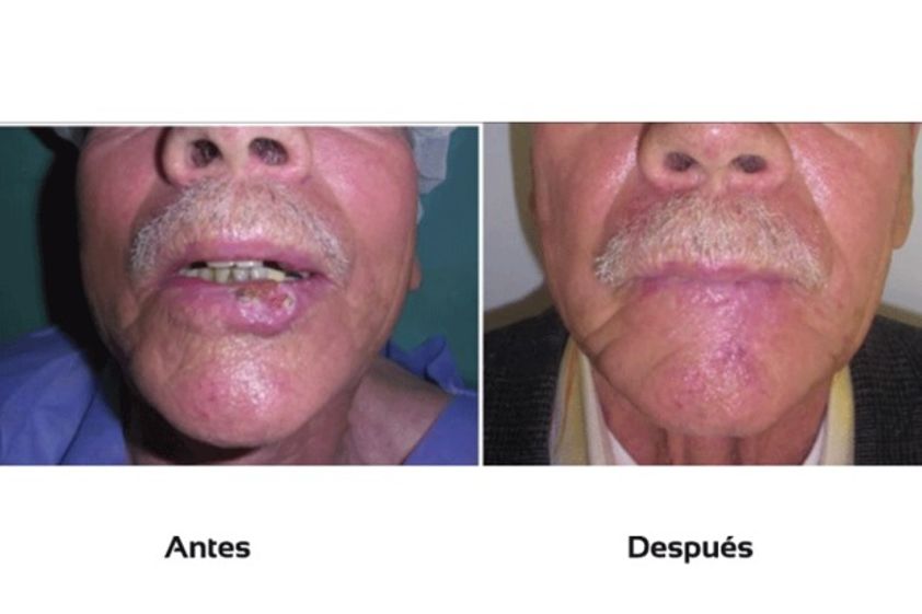 Cirugía reconstructiva antes y después - 511059