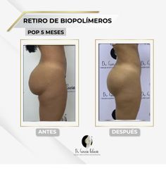Retiro de Biopolímeros - Dr. García Palacio