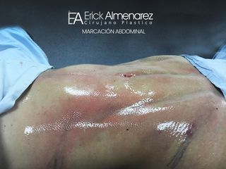 Dr Erick Almenarez