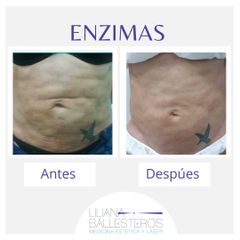 Enzimas - Dra. Liliana Ballesteros