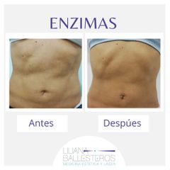 Enzimas - Dra. Liliana Ballesteros