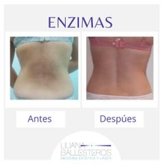Enzimas - Dra. Liliana Ballesteros