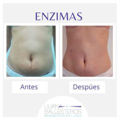 Enzimas - Dra. Liliana Ballesteros