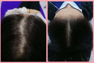 Tratamientos para el cabello - Dra. Liliana Ballesteros