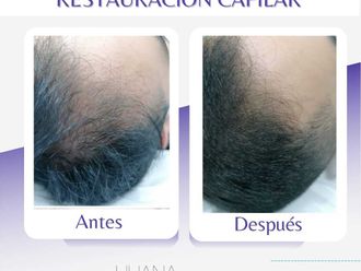 Tratamientos para el cabello - 816053