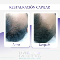 Tratamientos para el cabello - Dra. Liliana Ballesteros