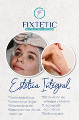 Fixtetic