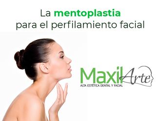 Mentoplastia - 630701
