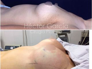 Dr Héctor García Cirugía Plástica