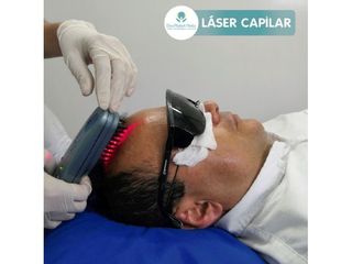 Láser Capilar